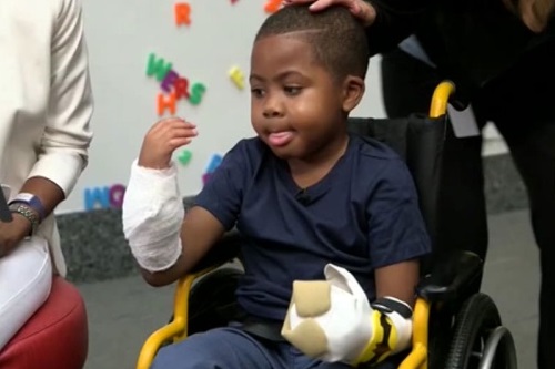 В США хирурги пересадили восьмилетнему мальчику кисти рук