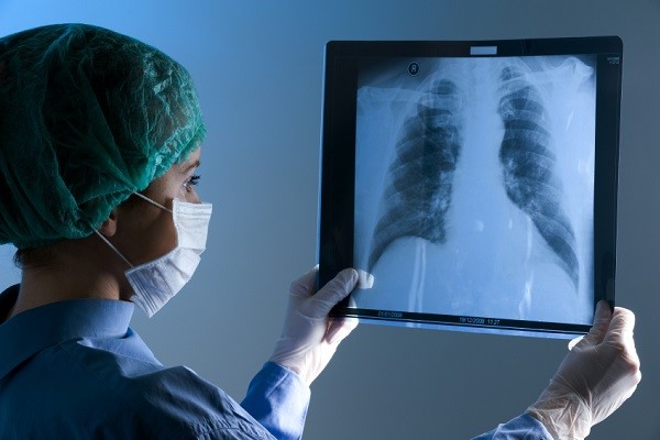 Мифы о рентгенологических исследованиях