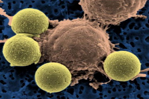 Тиоридазин убивает стволовые раковые клетки