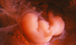 Зарождение жизни: 1-4 неделя беременности