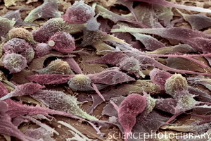 Раковые стволовые клетки