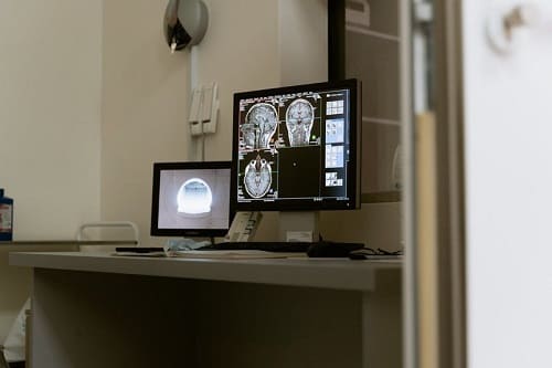 Магнитно-резонансная томография головы: кому нужна и что дает