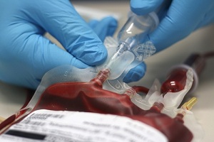 В Томске впервые проведена операция по внутриутробному переливанию крови плоду